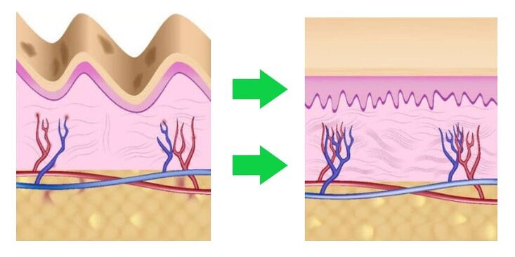 Intenskin aligns the skin