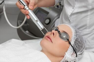 benefits of laser resurfacing